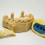 moulage dents